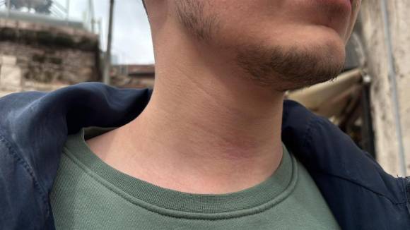 Gazeteciye Saldırdılar, BGYD'den Sert Tepki! “Basın Özgürlüğüne Açık Saldırı”