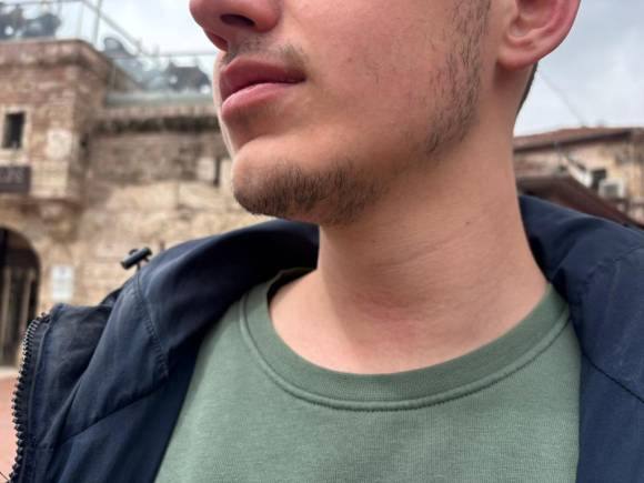 Gazeteciye Saldırdılar, BGYD'den Sert Tepki! “Basın Özgürlüğüne Açık Saldırı”