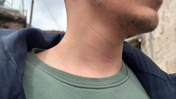 Gazeteciye Saldırdılar, BGYD'den Sert Tepki! “Basın Özgürlüğüne Açık Saldırı”