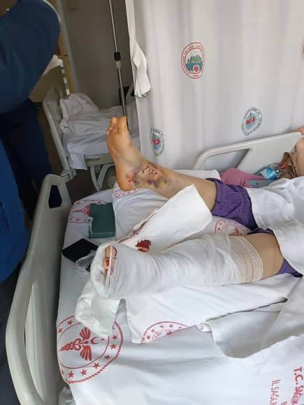 Bolu'da Korkunç Olay! Eşini Araçla Öldürmeye Kalkıştı